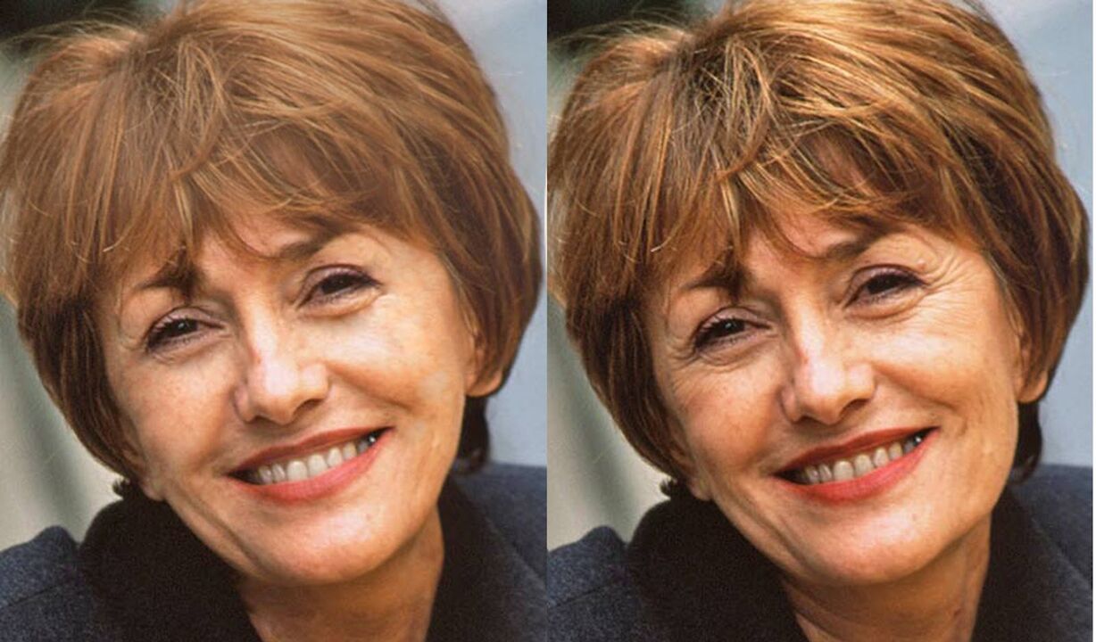 a photograph of the face before and after contouring